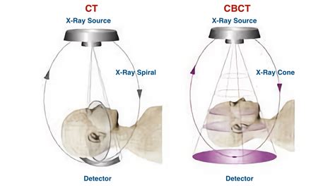 cbct vs ct